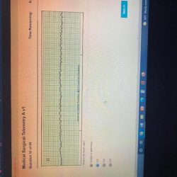 Relias medical surgical-telemetry rn a answers 2023