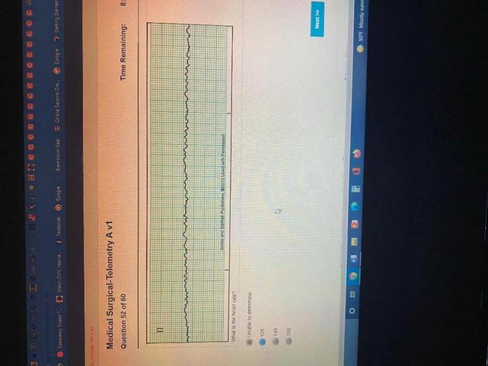 Relias medical surgical-telemetry rn a answers 2023